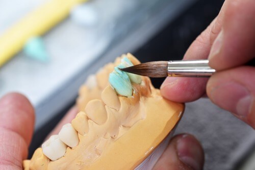 dentist making veneer