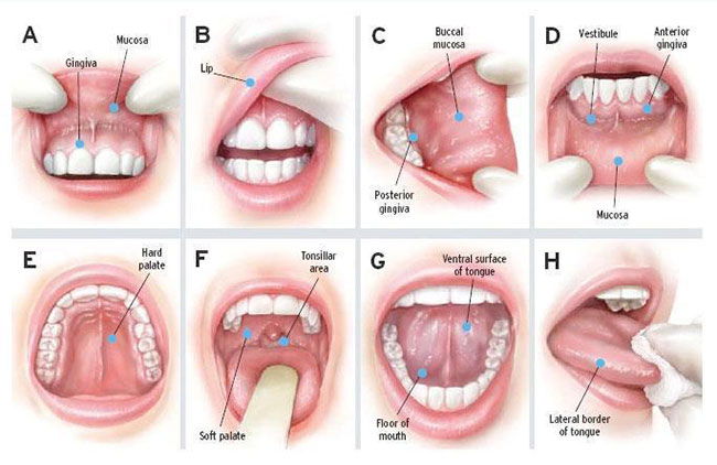 Are You Getting Regular Oral Cancer Screenings?